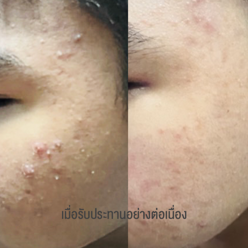 รูปคนรีวิว 2