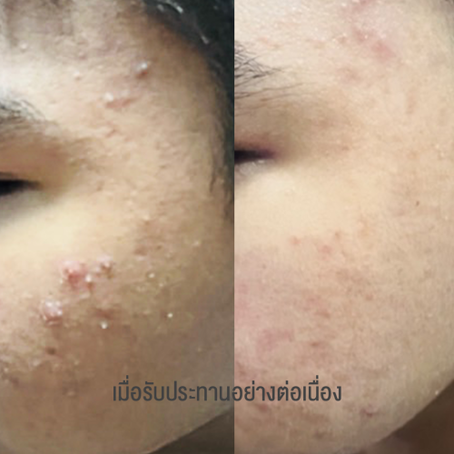 รูปคนรีวิว 2